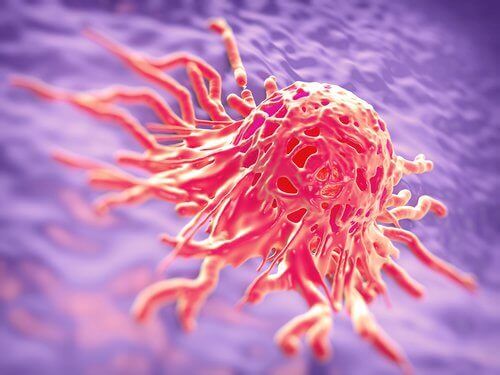 Cancercell - orsakerna till bröstcancer