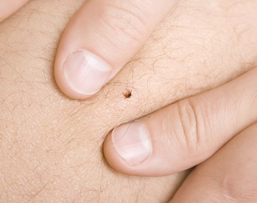 4 naturliga sätt att bli av med fästingar för gott