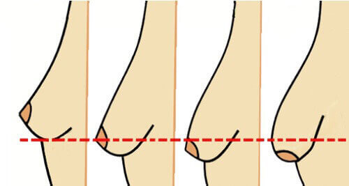 5 vanor som får brösten att bli hängiga