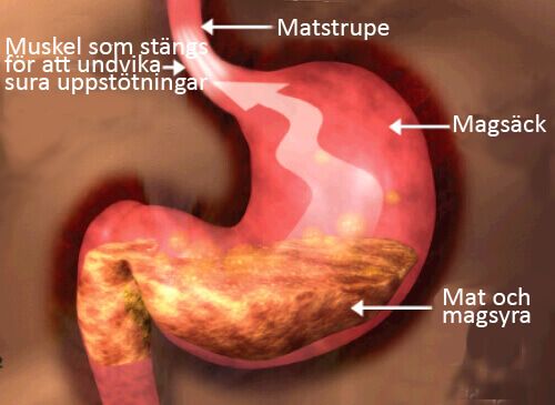Den rätta kosten för personer med reflux
