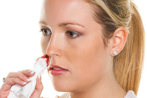 Naturliga och effektiva kurer för näsblod