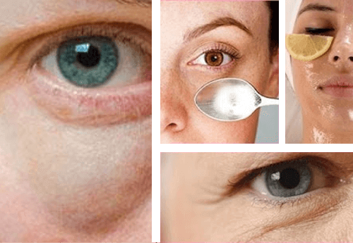 Enkla tips för att få bort påsar under ögonen