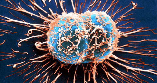 11 symtom på cancer som ofta ignoreras