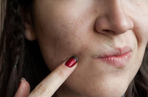 8 livsmedel som hjälper dig att rena huden