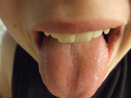 min tunga är vit