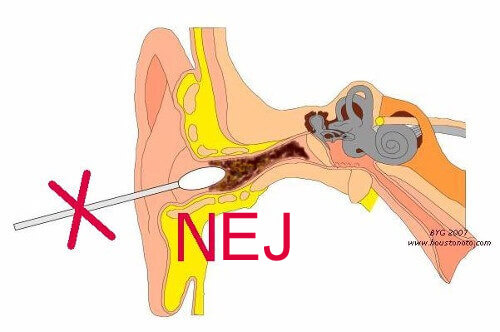 6 huskurer för att effektivt ta bort öronvax