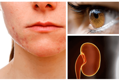 Vilka organ som påverkas av stress - och vad du kan göra