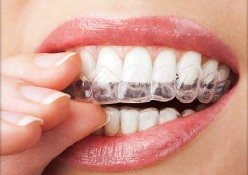 4 effektiva kurer för att motverka tandgnissling