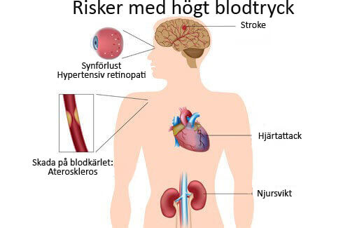 De bästa sätten att bekämpa högt blodtryck