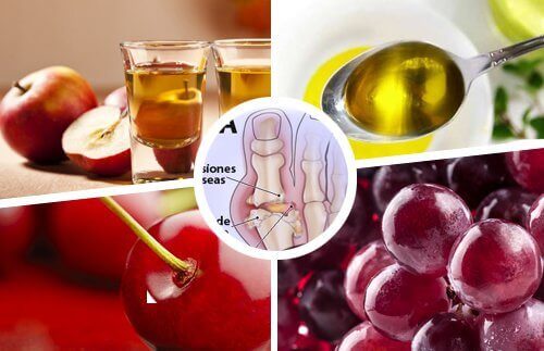 Använd huskurer för att bekämpa gikt