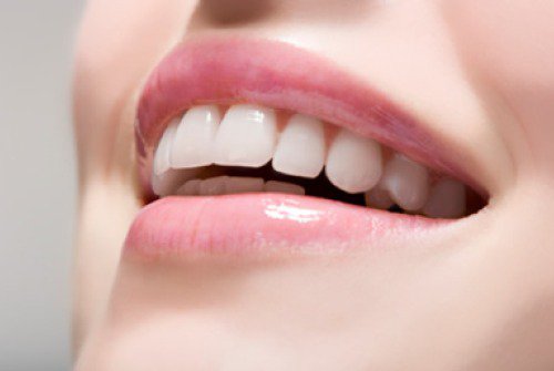 Vita tänder