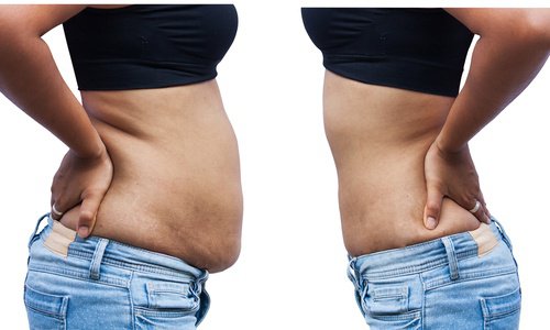 8 anledningar till varför magen ansamlar fett