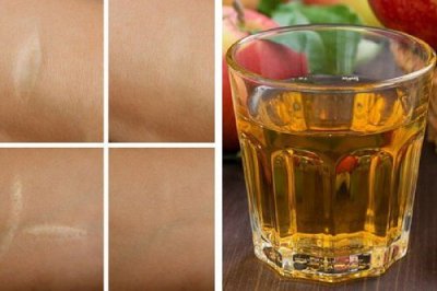 Antioxidant tonic mot rynkor, brännmärken och sår
