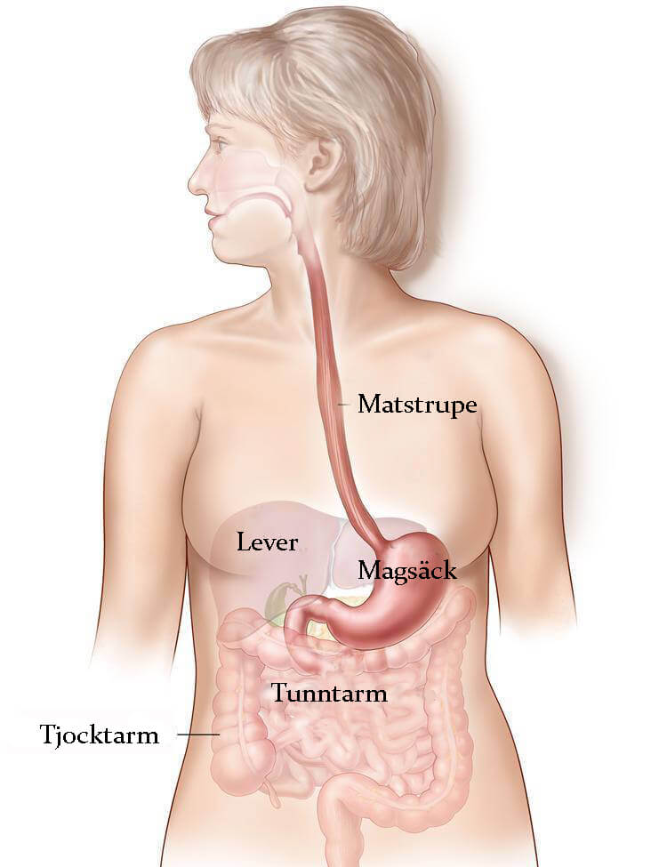 Känn till symtomen på matstrupssjukdomar
