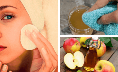 Använd äppelcidervinäger som ansiktstvätt