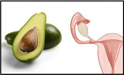 Avokado