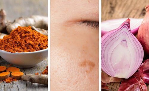 Har du märken på huden? Då kan dessa 6 huskurer hjälpa