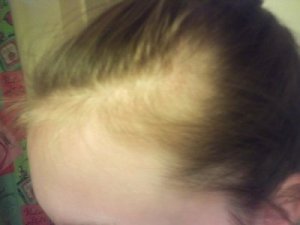 Motverka håravfall med basilika: huskur för starkare hår