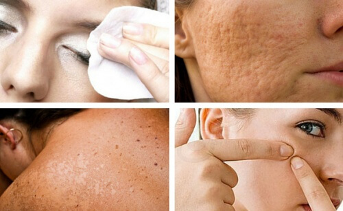 Sluta upp med dessa 7 vanor som skadar din hud