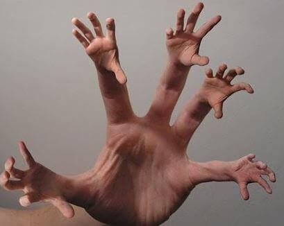 Alien-hand-syndrom