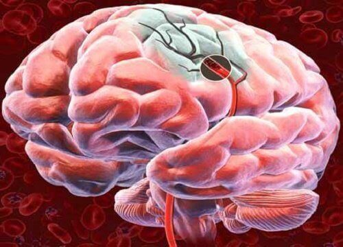 Upptäck 5 sätt att öka blodflödet till hjärnan