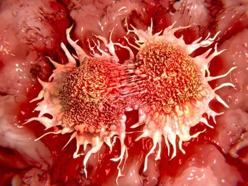 Cancerceller i kroppen