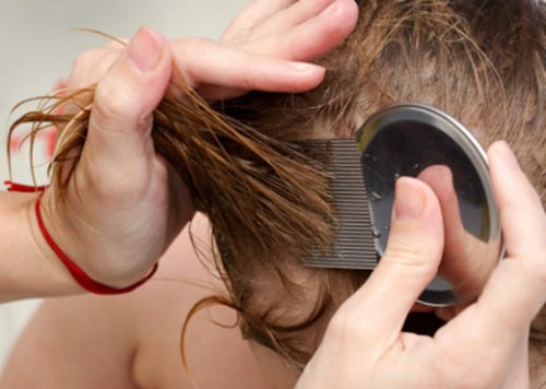 7 naturliga sätt att bli av med löss och gnetter
