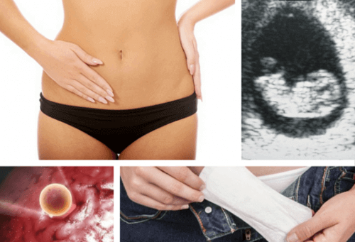 kan man ha mens när man är gravid