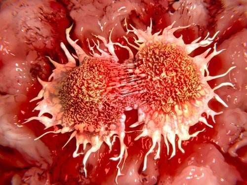 cancer