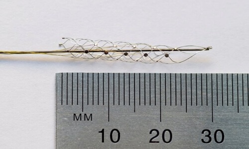 “Bionisk ryggrad” hjälper förlamade att gå igen