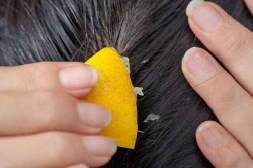 Bekämpa håravfall med citronjuice
