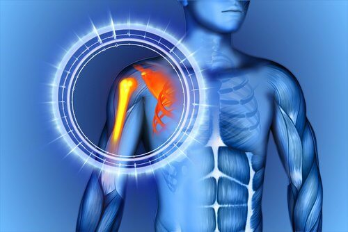 Hur man naturligt lindrar skelettsmärta