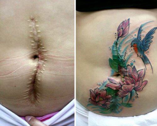 Tatueringar för att "sudda ut" livets sår