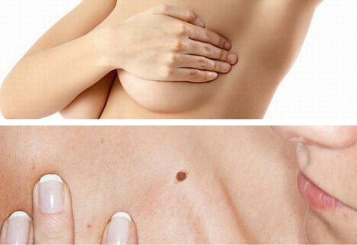 4 självundersökningar som kan rädda ditt liv