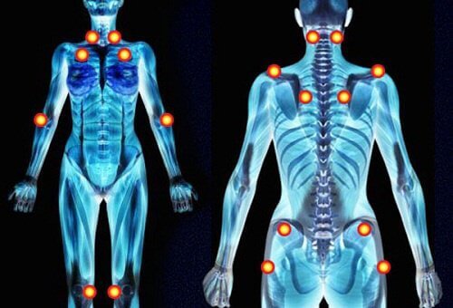 Tidiga varningstecken på fibromyalgi