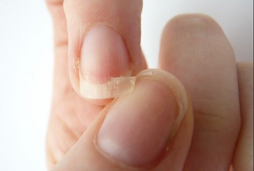 7 naturliga sätt att stärka sköra naglar