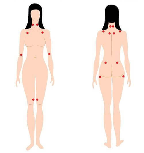 Lär dig känna igen tidiga varningstecken på fibromyalgi