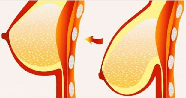 8 tips & behandlingar för hängiga bröst