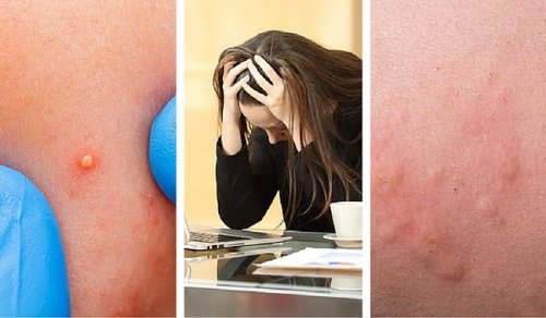 7 tecken på att dina stressnivåer är för höga