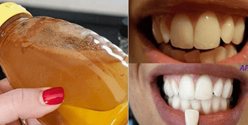 Få vitare tänder med 100% naturliga ingredienser
