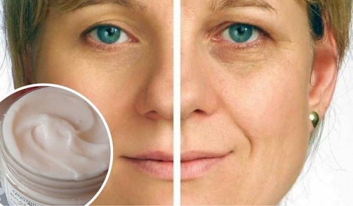 Bli av med rynkor med en åldersmotverkande kräm