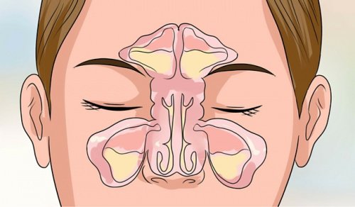 6 tips för att bli av med en täppt näsa inom några minuter