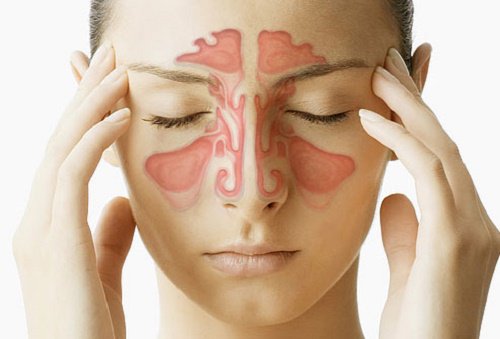 kronisk inflammation i näsan