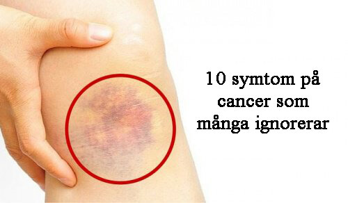 10 symtom på cancer som många ignorerar