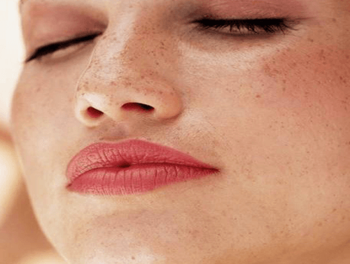 Hur du behandlar hudmärken naturligt