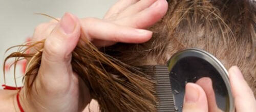 7 naturliga sätt att bli av med huvudlöss