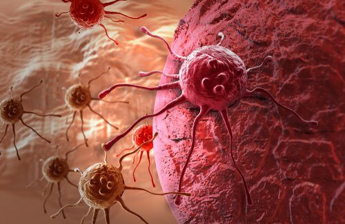 Cancer kan skapa besvär med magen
