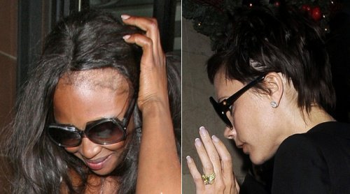 5 råd och tips för att dölja håravfall