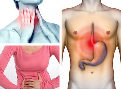 Du kan ha gastroesofageal reflux utan att veta om det