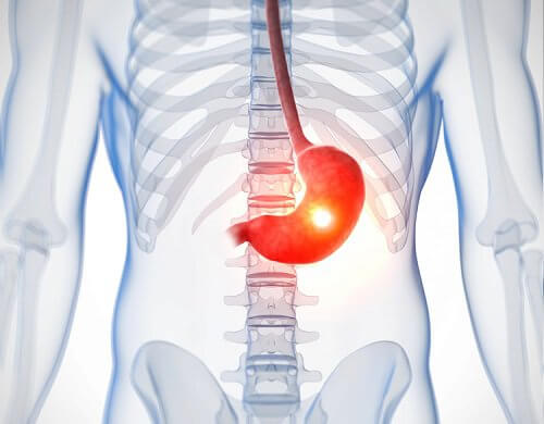 Problem med tarmarna